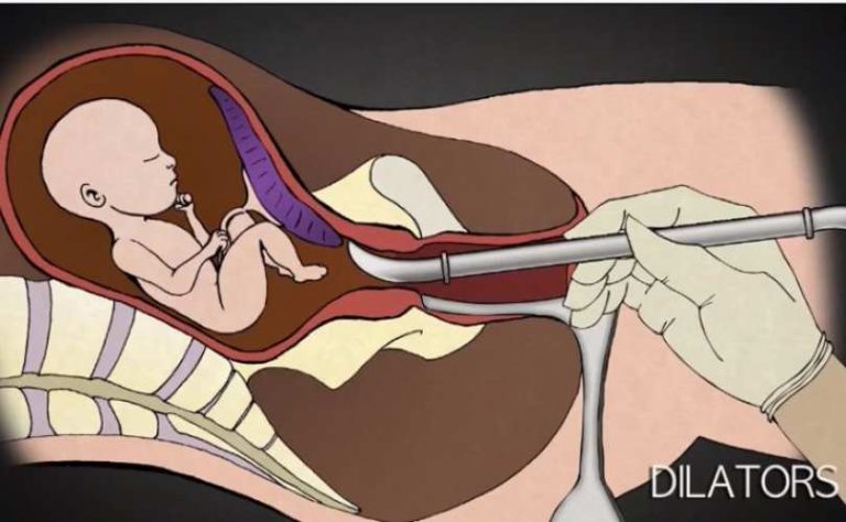 WATCH: A third of pro-choice women change their view of abortion after seeing this viral video