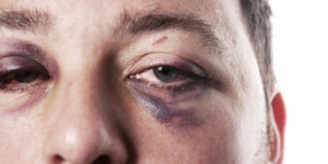 domestic violence man victim 2
