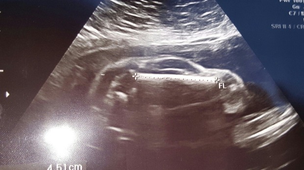 Congratulations – it’s a Ford Foetus