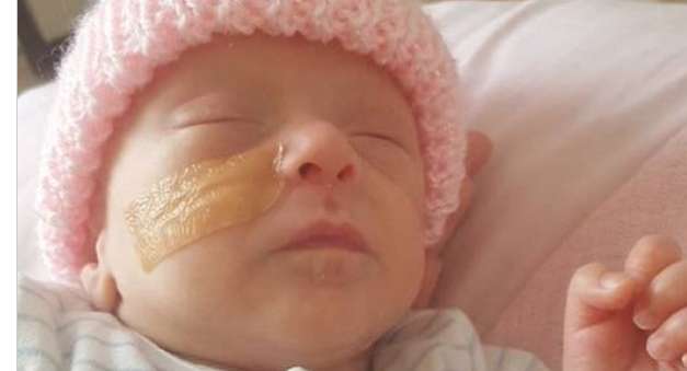 Sandwich bag saves baby born three months early
