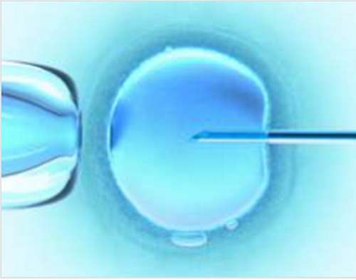 ‘IVF produces infertile kids’