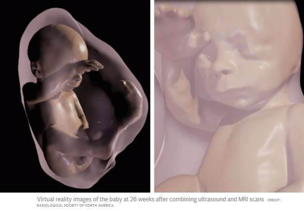 Parents can meet unborn children in 3D virtual reality