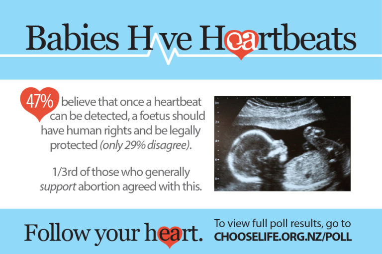 Poll: Majority thinks fetal heartbeat abortion bans aren’t too restrictive