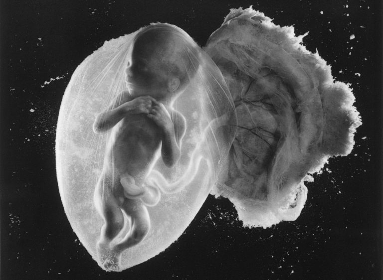 Foetus 18 Weeks: the greatest photograph of the 20th century?
